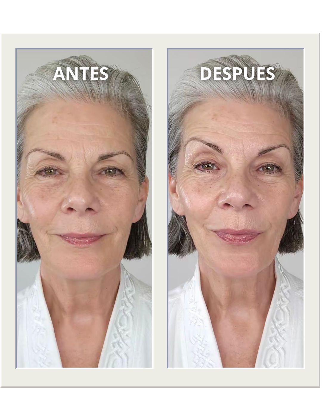 Masajeador Facial de la Piel